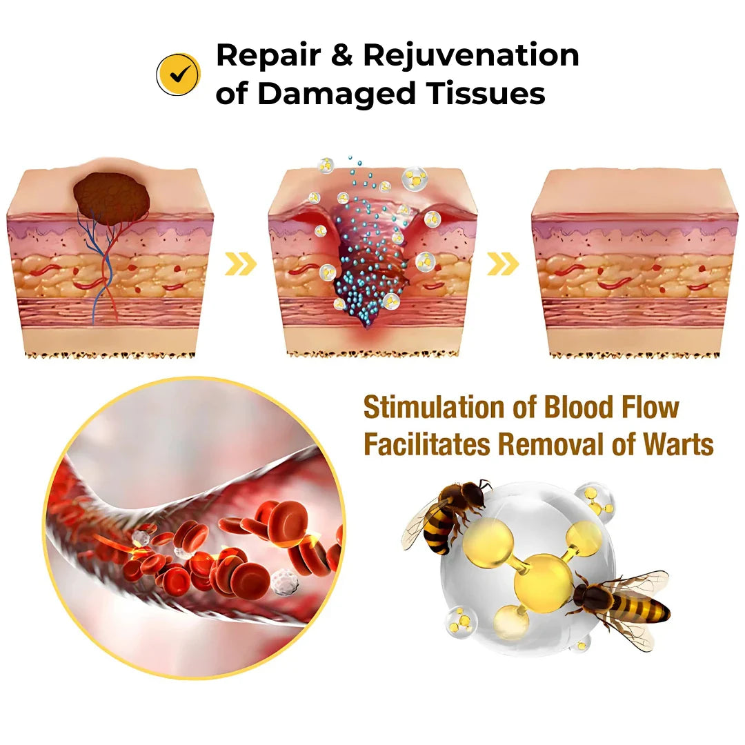 Derma Smooth Skin Tag Removal Patch