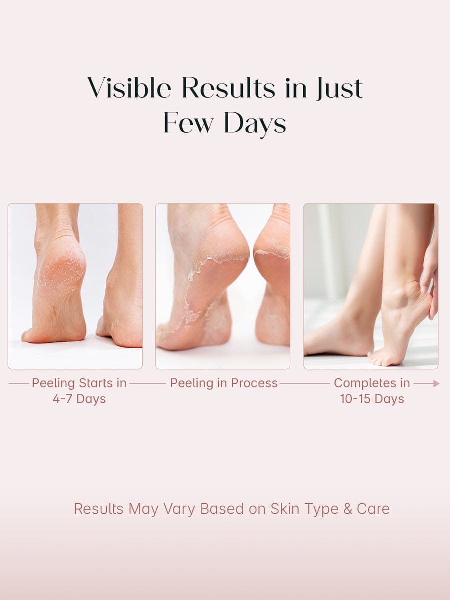 Foot Peeling Mask