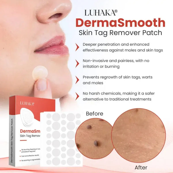 Derma Smooth Skin Tag Removal Patch
