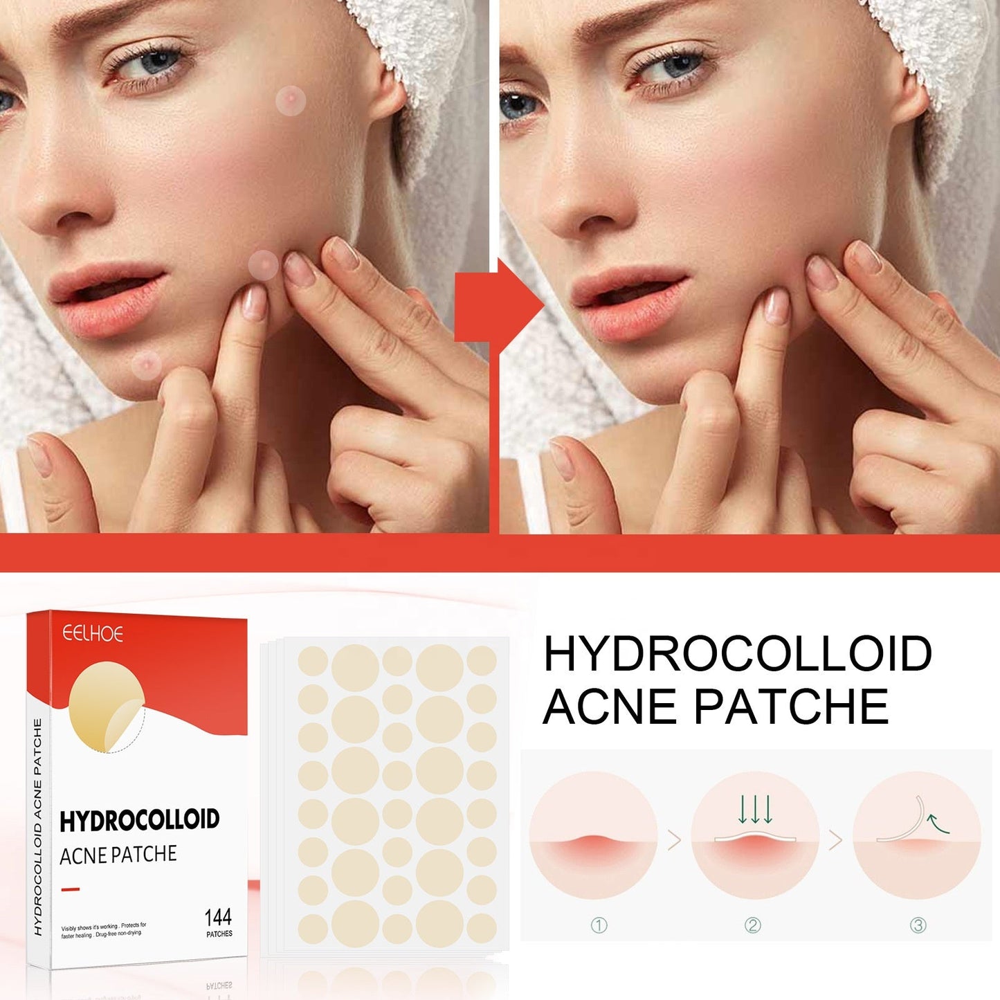 EELHOE Hydrocolloid Pimple Patch (PCS 144)