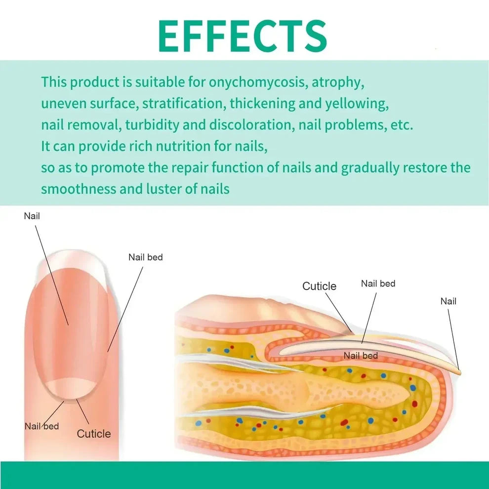 Nexusdrop Nail Fungus Solution